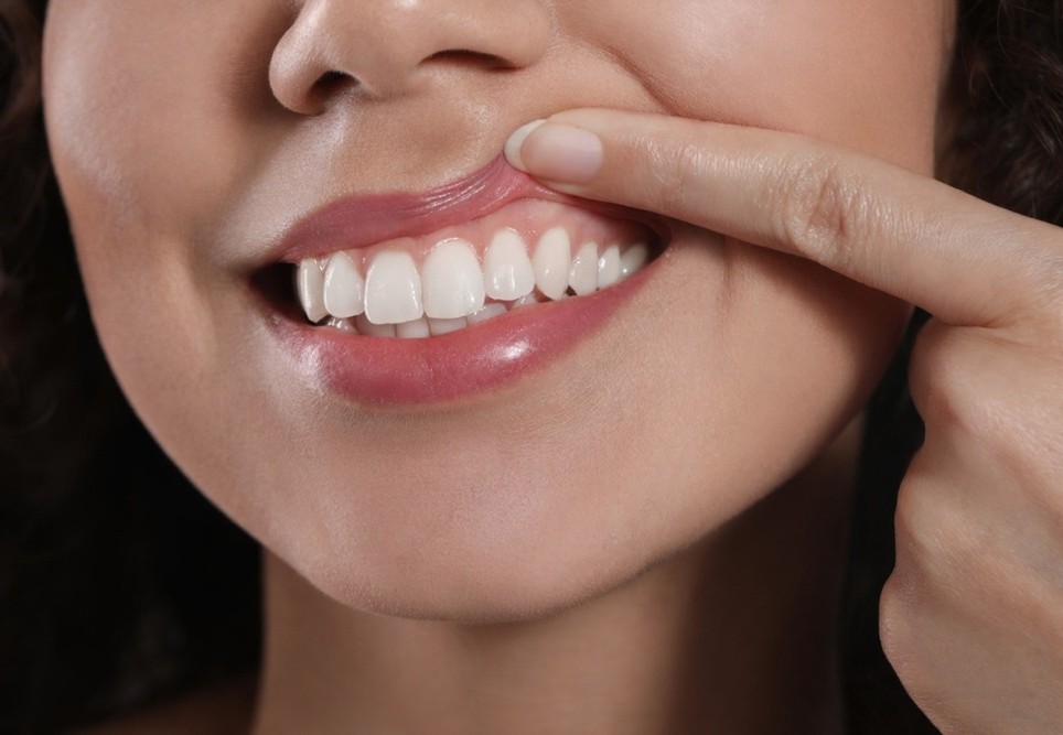 gum contouring near you